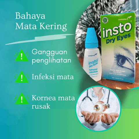 Mengatasi Mata Kering