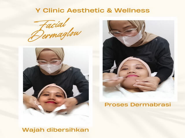 Dermabrasi