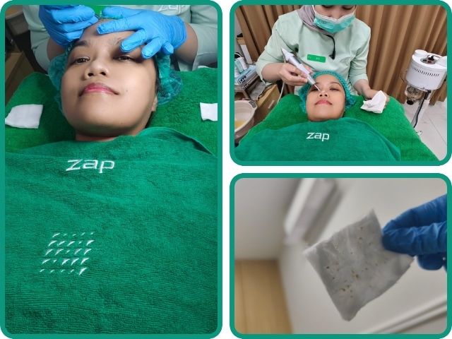 Tindakan Facial